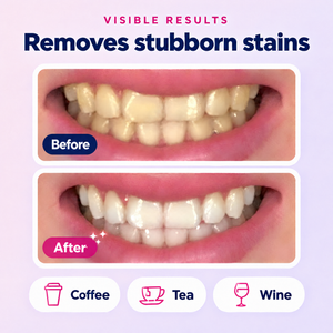 Before and after - removes stubborn stains